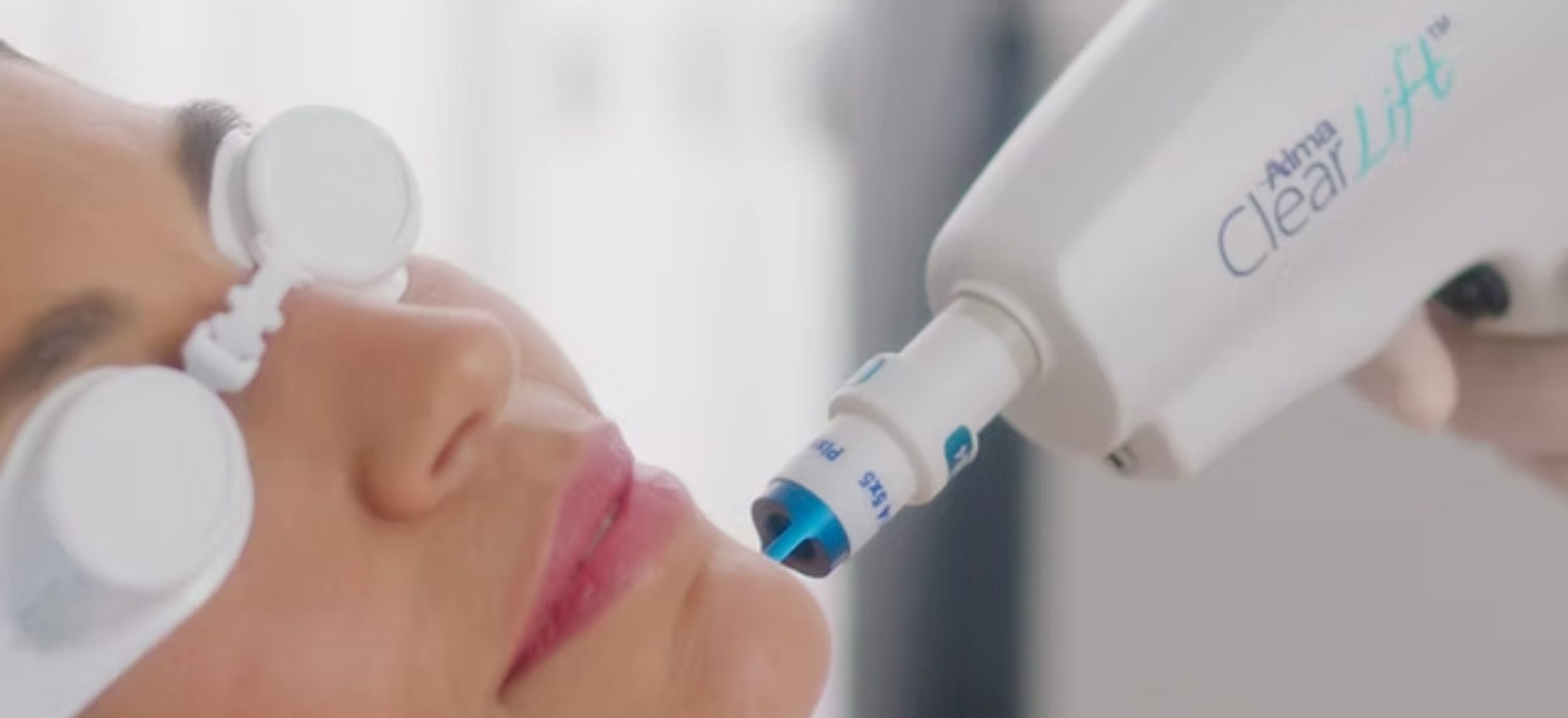 Alma ClearLift Lesion Removal scaled