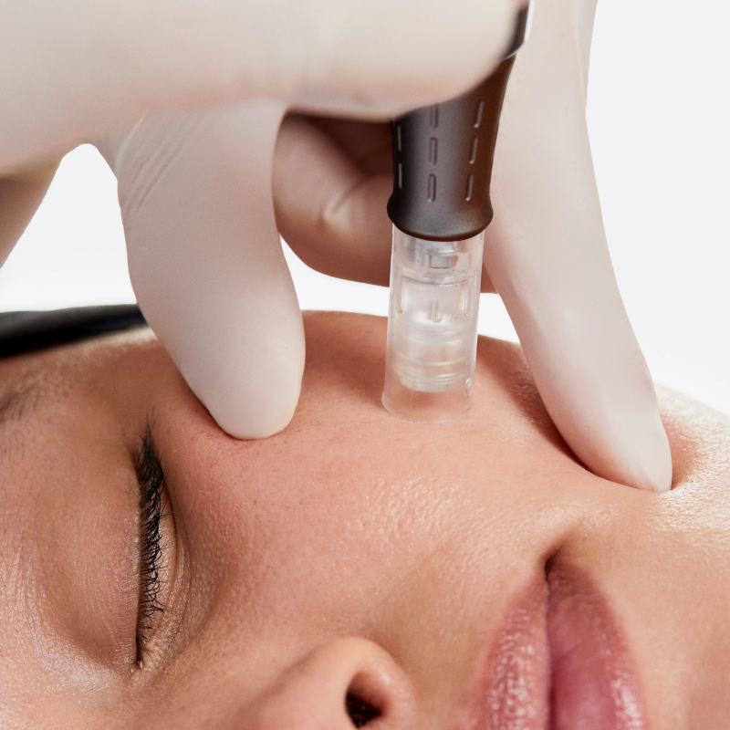 Dermalogica Pro Microneedling