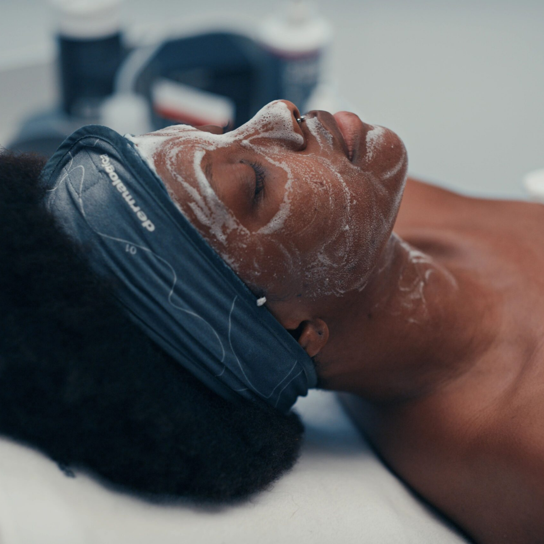 Treatments Chemical Peel