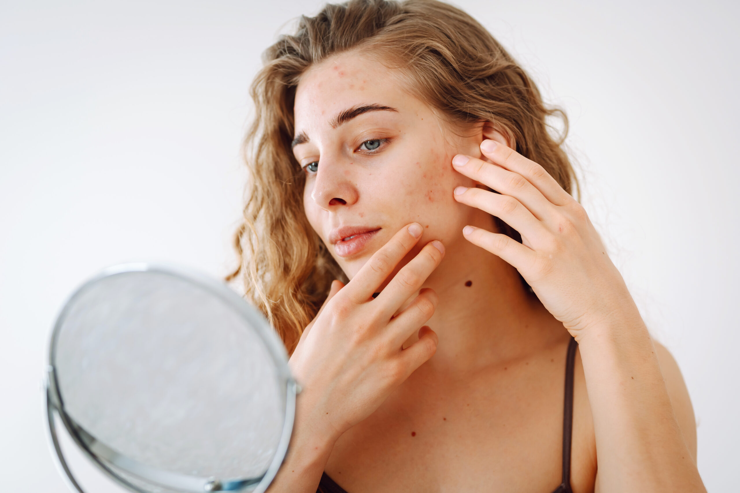 curly woman touches red inflammations her face while looking mirror bright room scaled