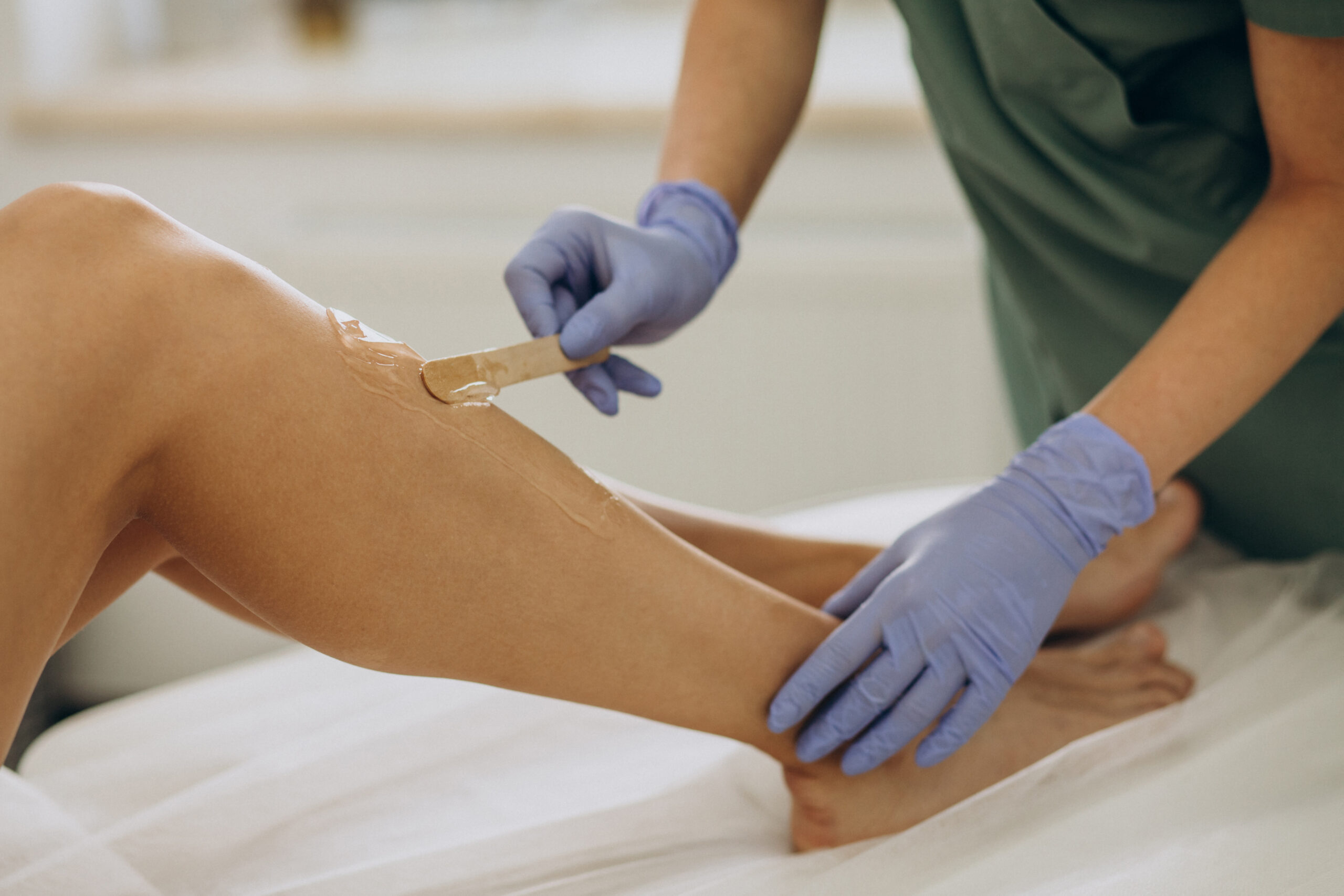laser epilation hair removal therapy 5 scaled
